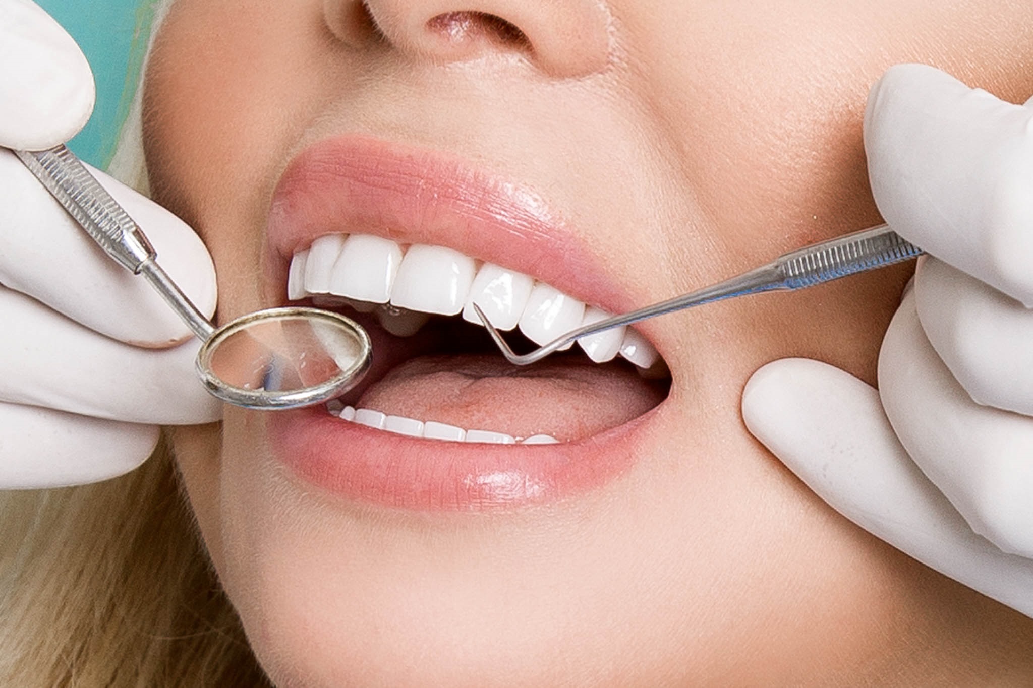 three varieties of dental cleanings